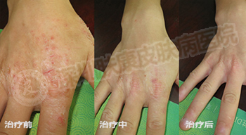 ���ݱ���Ƥ����