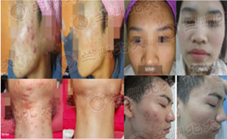 ���ݱ���Ƥ����