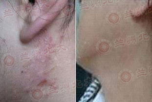 ���ݱ���Ƥ����