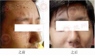 ���ݱ���Ƥ����