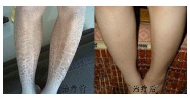 ���ݱ���Ƥ����