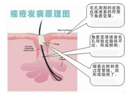 ���ݱ���Ƥ����