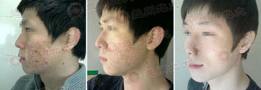 ���ݱ���Ƥ����