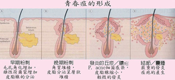 ���ݱ���Ƥ����