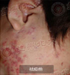 ���ݱ���Ƥ����