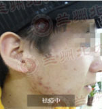 ���ݱ���Ƥ����