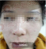 ���ݱ���Ƥ����