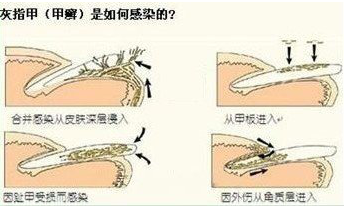 ���ݱ���Ƥ����