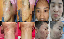 ���ݱ���Ƥ����