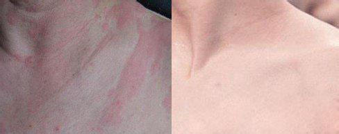 ���ݱ���Ƥ����