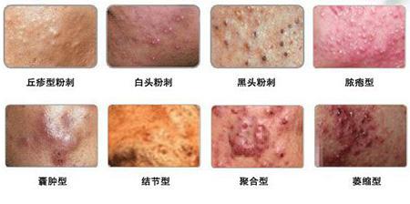 ���ݱ���Ƥ����