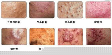 ���ݱ���Ƥ����