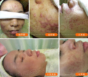 ���ݱ���Ƥ����