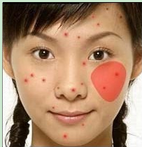 ���ݱ���Ƥ����