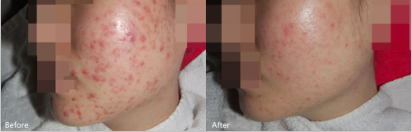 ���ݱ���Ƥ����