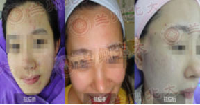 ���ݱ���Ƥ����