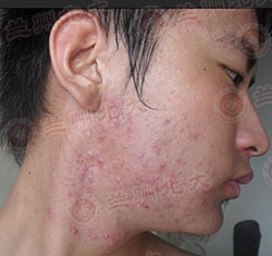 ���ݱ���Ƥ����