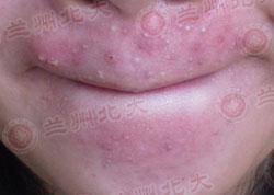 ���ݱ���Ƥ����