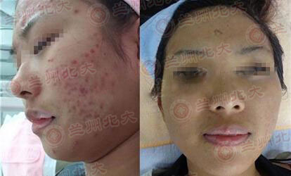 ���ݱ���Ƥ����