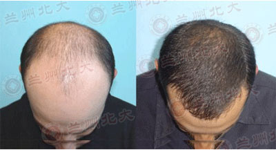 ���ݱ���Ƥ����