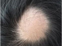 ���ݱ���Ƥ����