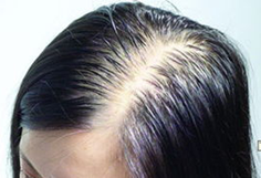 ���ݱ���Ƥ����