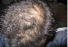 ���ݱ���Ƥ����