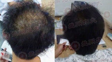 ���ݱ���Ƥ����