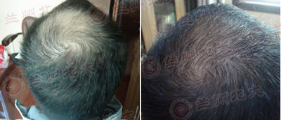 ���ݱ���Ƥ����