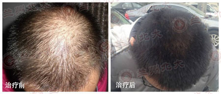 ���ݱ���Ƥ����