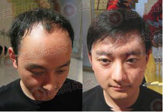 ���ݱ���Ƥ����