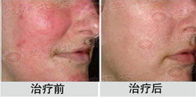 ���ݱ���Ƥ����