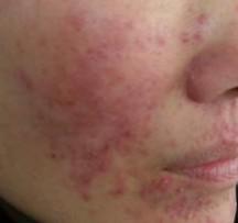 ���ݱ���Ƥ����