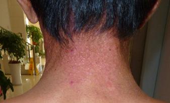 ���ݱ���Ƥ����