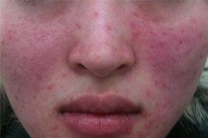 ���ݱ���Ƥ����