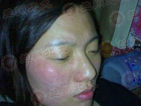 ���ݱ���Ƥ����