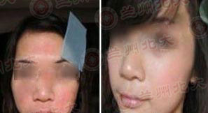 ���ݱ���Ƥ����