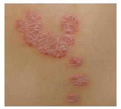 ���ݱ���Ƥ����