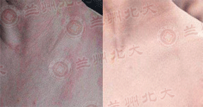 ���ݱ���Ƥ����