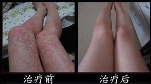 ���ݱ���Ƥ����