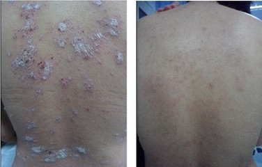 ���ݱ���Ƥ����