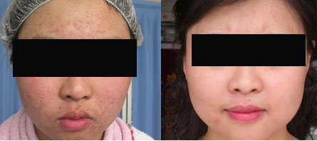 ���ݱ���Ƥ����