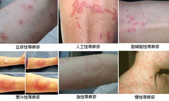 ���ݱ���Ƥ����