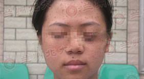 ���ݱ���Ƥ����