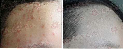 ���ݱ���Ƥ����