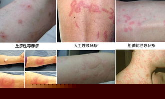 ���ݱ���Ƥ����