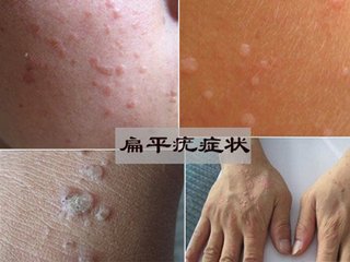 ���ݱ���Ƥ����