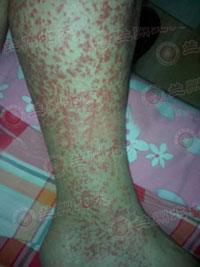 ���ݱ���Ƥ����