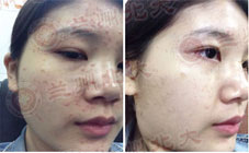 ���ݱ���Ƥ����