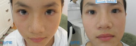 ���ݱ���Ƥ����